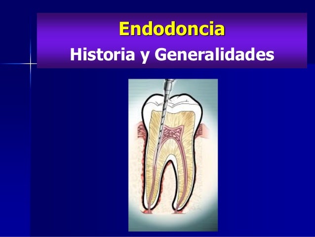 Historia delaendodoncia