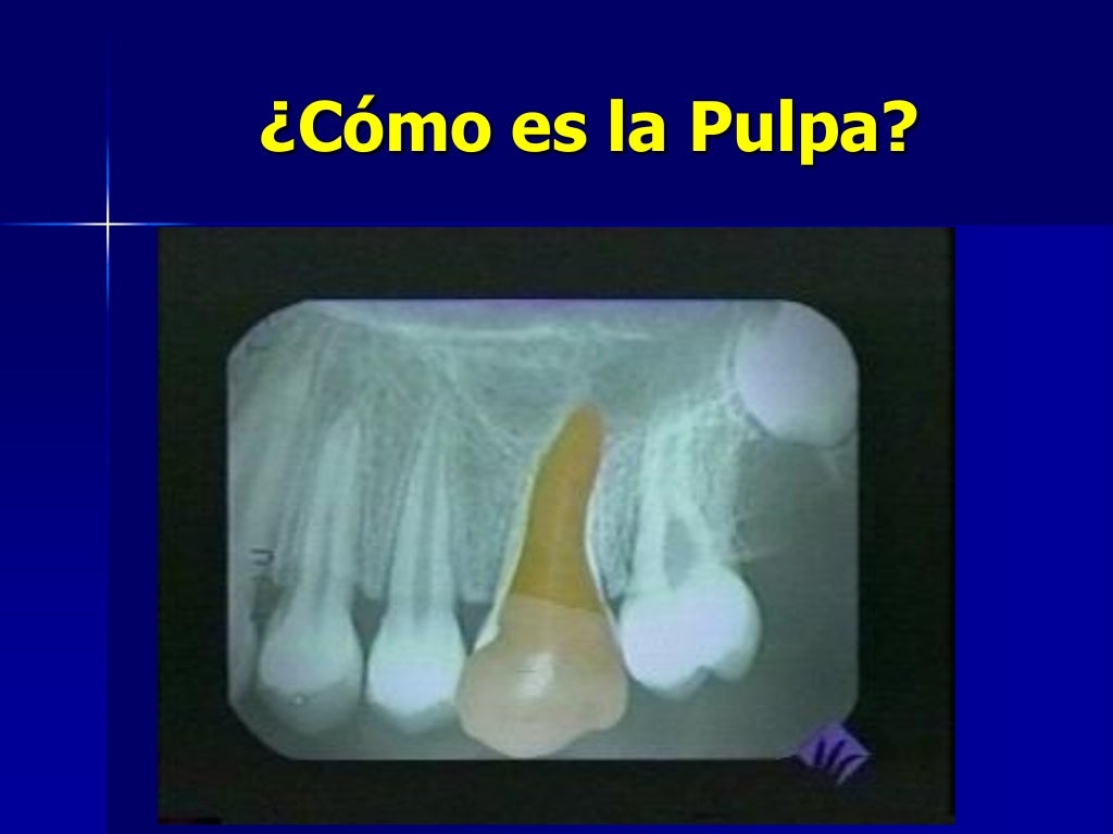 Historia delaendodoncia