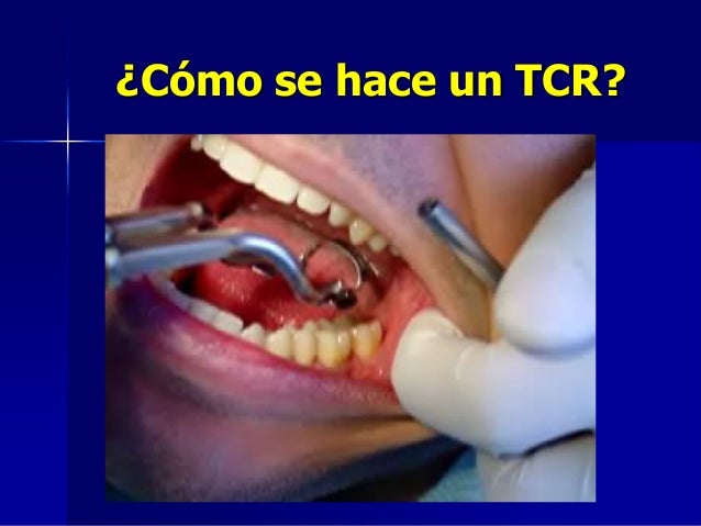 Historia delaendodoncia