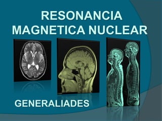 RESONANCIA
MAGNETICA NUCLEAR
GENERALIADES
 