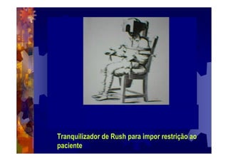 Tranquilizador de Rush para impor restrição ao
paciente
 