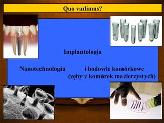 Historia chorób zębów i przyzębia