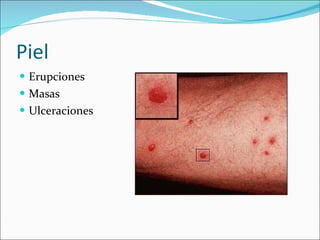Piel Erupciones Masas Ulceraciones 