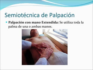Semiotécnica de Palpación Palpación con mano Extendida:  Se utiliza toda la palma de una o ambas manos. 