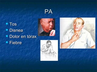 PA
   Tos
   Disnea
   Dolor en tórax
   Fiebre
 