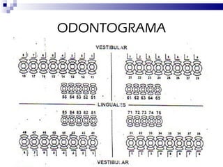 ODONTOGRAMA 