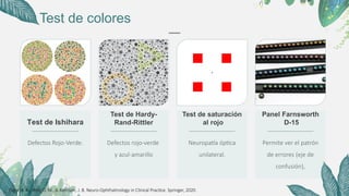 Hardy Randy Rittler Historia clinica neuro oftalmologica .pptx