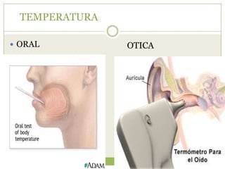 TEMPERATURA

 ORAL          OTICA
 