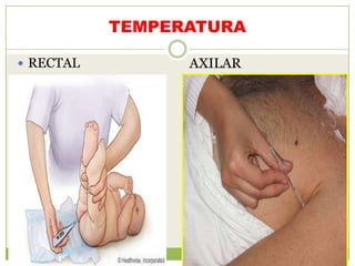 TEMPERATURA

 RECTAL         AXILAR
 
