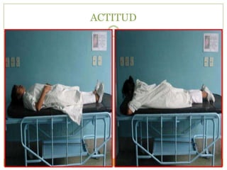 ACTITUD
 