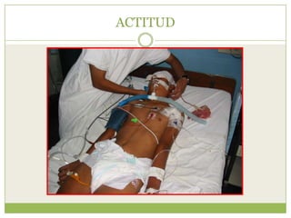 ACTITUD
 