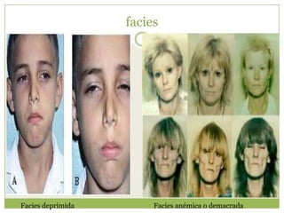 facies




Facies deprimida        Facies anémica o demacrada
 