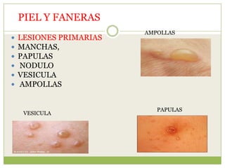 PIEL Y FANERAS
                         AMPOLLAS
   LESIONES PRIMARIAS
   MANCHAS,
   PAPULAS
   NODULO
   VESICULA
   AMPOLLAS


                            PAPULAS
     VESICULA
 