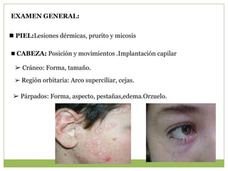 EXAMEN GENERAL:


 PIEL:Lesiones dérmicas, prurito y micosis

 CABEZA: Posición y movimientos .Implantación capilar

 ➢ Cráneo: Forma, tamaño.
 ➢ Región orbitaria: Arco superciliar, cejas.

 ➢ Párpados: Forma, aspecto, pestañas,edema.Orzuelo.
 