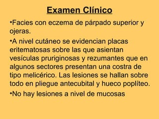 Examen Clínico
•Facies con eczema de párpado superior y
ojeras.
•A nivel cutáneo se evidencian placas
eritematosas sobre las que asientan
vesículas pruriginosas y rezumantes que en
algunos sectores presentan una costra de
tipo melicérico. Las lesiones se hallan sobre
todo en pliegue antecubital y hueco poplíteo.
•No hay lesiones a nivel de mucosas
 