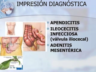 IMPRESIÓN DIAGNÓSTICA
 APENDICITIS
 ILEOCECITIS
INFECCIOSA
(válvula iliocecal)
 ADENITIS
MESENTÉRICA
 
