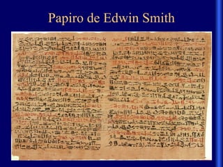 Papiro de Edwin Smith
 