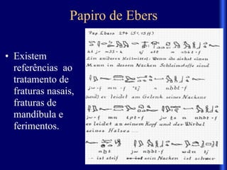 Papiro de Ebers
• Existem
referências ao
tratamento de
fraturas nasais,
fraturas de
mandíbula e
ferimentos.
 