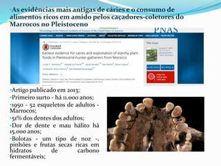 •As evidências mais antigas de cáries e o consumo de
alimentos ricos em amido pelos caçadores-coletores do
Marrocos no Pleistoceno
•Artigo publicado em 2013;
•Primeiro surto - há 11.000 anos;
•1950 - 52 esqueletos de adultos -
Marrocos;
•51% dos dentes dos adultos;
•Dor de dente e mau hálito há
15.000 anos;
•Bolotas - um tipo de noz -,
pinhões e frutas secas ricas em
hidratos de carbono
fermentáveis;
 