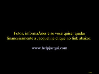 Fotos, informações e se você quiser ajudar financeiramente a Jacqueline clique no link abaixo:  www.helpjacqui.com >>> 