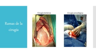 Ramas de la
cirugía
Cirugía torácica Cirugía oncológica
 