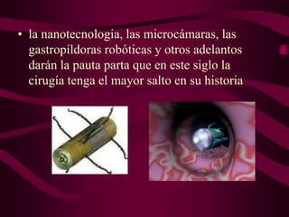 • la nanotecnologia, las microcámaras, las
gastropíldoras robóticas y otros adelantos
darán la pauta parta que en este siglo la
cirugía tenga el mayor salto en su historia

 