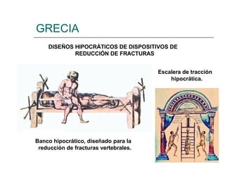 GRECIA
DISEÑOS HIPOCRÁTICOS DE DISPOSITIVOS DE
REDUCCIÓN DE FRACTURAS
Escalera de tracción
hipocrática.
Banco hipocrático, diseñado para la
reducción de fracturas vertebrales.
 