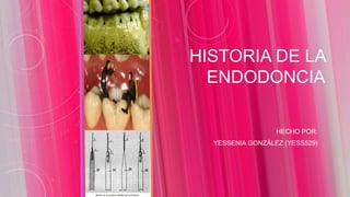 HISTORIA DE LA
ENDODONCIA
HECHO POR:
YESSENIA GONZÁLEZ (YESS529)
 