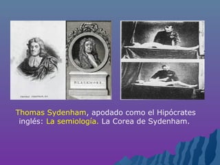 Thomas Sydenham, apodado como el Hipócrates
inglés: La semiología. La Corea de Sydenham.
 