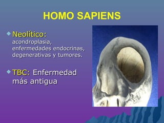 HOMO SAPIENS
 Neolítico:Neolítico:
acondroplasia,acondroplasia,
enfermedades endocrinas,enfermedades endocrinas,
degenerativas y tumores.degenerativas y tumores.
 TBC:TBC: EnfermedadEnfermedad
más antiguamás antigua
 