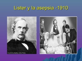 Lister y la asepsia -1910Lister y la asepsia -1910
 