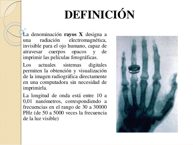 Historia de los rayos x