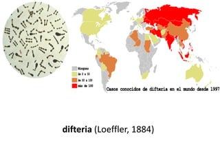 difteria (Loeffler, 1884)
 