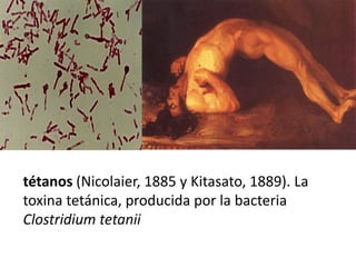 tétanos (Nicolaier, 1885 y Kitasato, 1889). La
toxina tetánica, producida por la bacteria
Clostridium tetanii
 