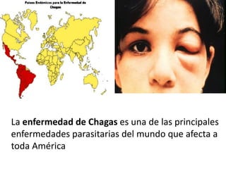 La enfermedad de Chagas es una de las principales
enfermedades parasitarias del mundo que afecta a
toda América
 