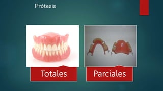 Prótesis
Totales Parciales
 