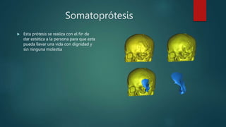 Somatoprótesis
 Esta prótesis se realiza con el fin de
dar estética a la persona para que esta
pueda llevar una vida con dignidad y
sin ninguna molestia
 