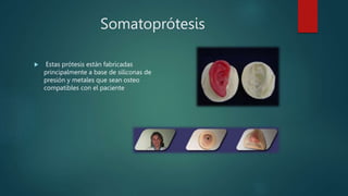 Somatoprótesis
 Estas prótesis están fabricadas
principalmente a base de siliconas de
presión y metales que sean osteo
compatibles con el paciente
 