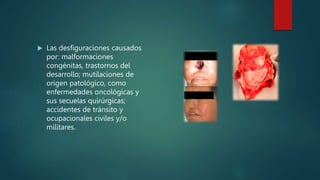  Las desfiguraciones causados
por: malformaciones
congénitas, trastornos del
desarrollo; mutilaciones de
origen patológico, como
enfermedades oncológicas y
sus secuelas quirúrgicas;
accidentes de tránsito y
ocupacionales civiles y/o
militares.
 
