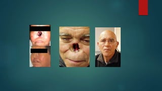 HISTORIA DE LA ODONTOLOGIA Y CONCEPTOS BASICOS.pptx