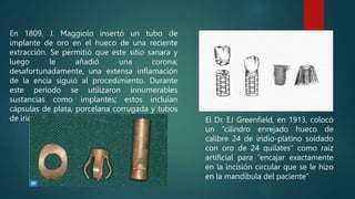 En 1809, J. Maggiolo insertó un tubo de
implante de oro en el hueco de una reciente
extracción. Se permitió que este sitio sanara y
luego le añadió una corona;
desafortunadamente, una extensa inflamación
de la encía siguió al procedimiento. Durante
este período se utilizaron innumerables
sustancias como implantes; estos incluían
cápsulas de plata, porcelana corrugada y tubos
de iridio. El Dr. EJ Greenfield, en 1913, colocó
un “cilindro enrejado hueco de
calibre 24 de iridio-platino soldado
con oro de 24 quilates” como raíz
artificial para “encajar exactamente
en la incisión circular que se le hizo
en la mandíbula del paciente”
 