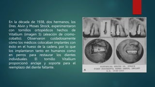 En la década de 1938, dos hermanos, los
Dres. Alvin y Moses Strock, experimentaron
con tornillos ortopédicos hechos de
Vitallium (imagen 5) (aleación de cromo-
cobalto). Observaron cuidadosamente
cómo los médicos colocaban implantes con
éxito en el hueso de la cadera, por lo que
los implantaron tanto en humanos como
en perros para restaurar los dientes
individuales. El tornillo Vitallium
proporcionó anclaje y soporte para el
reemplazo del diente faltante.
 