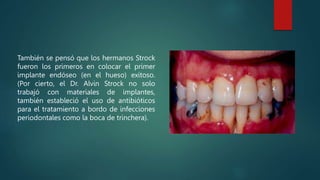 También se pensó que los hermanos Strock
fueron los primeros en colocar el primer
implante endóseo (en el hueso) exitoso.
(Por cierto, el Dr. Alvin Strock no solo
trabajó con materiales de implantes,
también estableció el uso de antibióticos
para el tratamiento a bordo de infecciones
periodontales como la boca de trinchera).
 