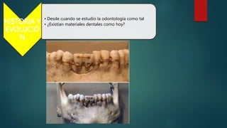 HISTORIA Y
EVOLUCIÓ
N
• Desde cuando se estudio la odontología como tal
• ¿Existían materiales dentales como hoy?
 