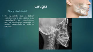 Cirugía
Oral y Maxilofacial
 Por especialistas que se dedican
exclusivamente a esa práctica, exige
especialización, con conocimientos
que los odontologos generales no
pueden desarrollarla en toda su
magnitud.
 