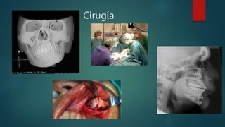 Cirugía
 