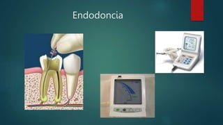 Endodoncia
 