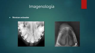 Imagenología
 Técnicas oclusales
 