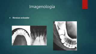 Imagenología
 Técnicas oclusales
 