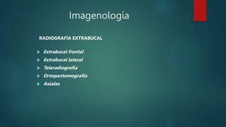 Imagenología
RADIOGRAFÍA EXTRABUCAL
 Extrabucal frontal
 Extrabucal lateral
 Teleradiografía
 Ortopantomografía
 Axiales
 